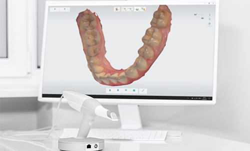 digital dental clinic in chennai