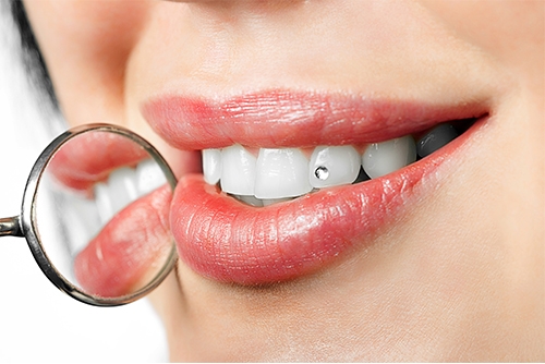 tooth jewellery in chennai
