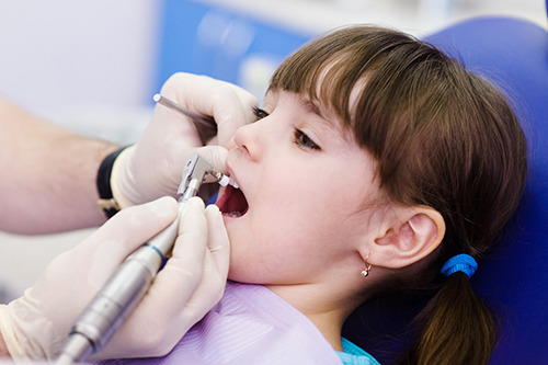 teeth scaling in chennai