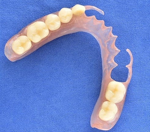 denture in chennai