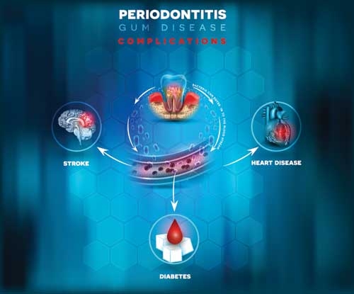 periodontist near me in chennai